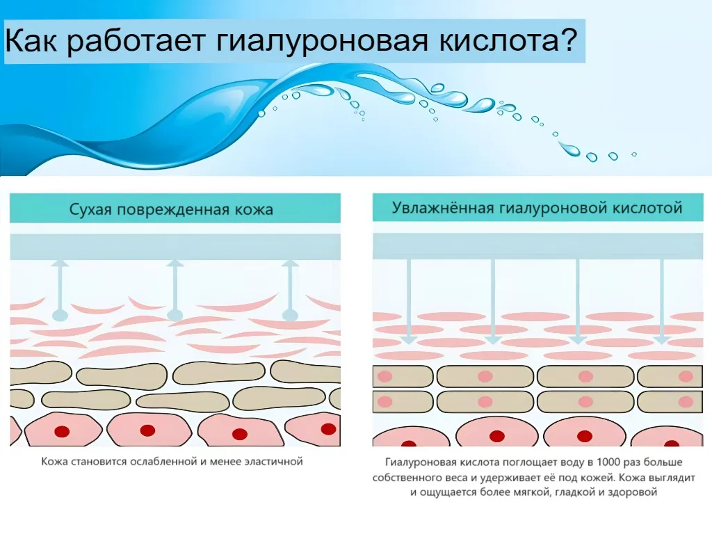 Как работает гиалуроновая кислота