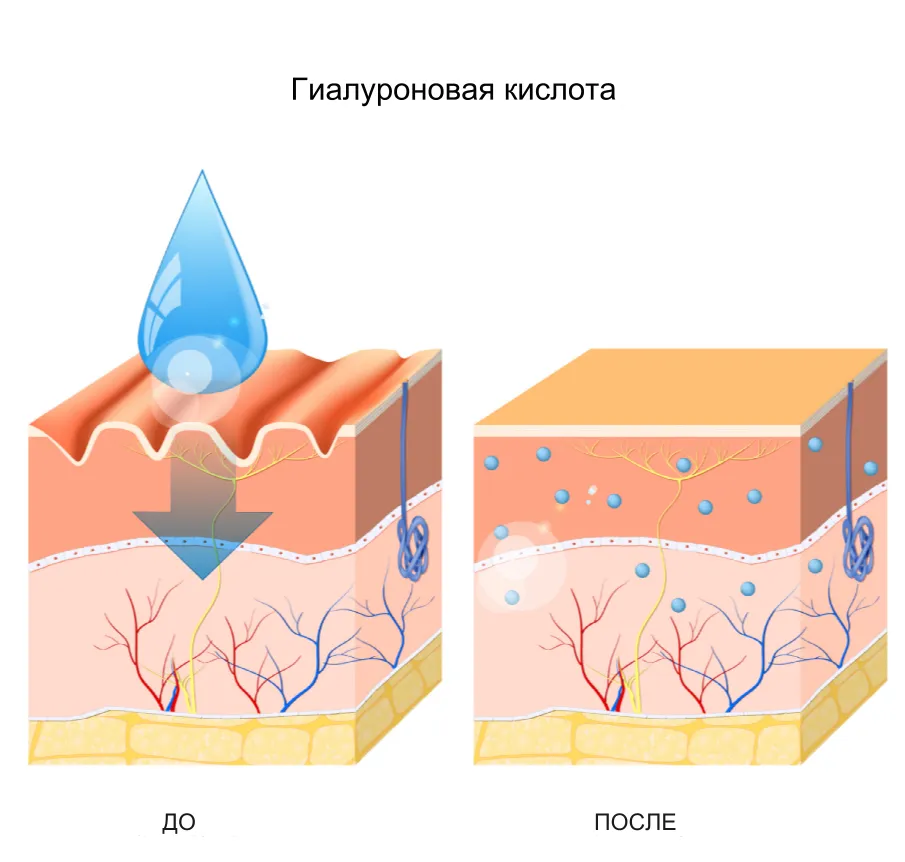 Что такое гиалуроновая кислота