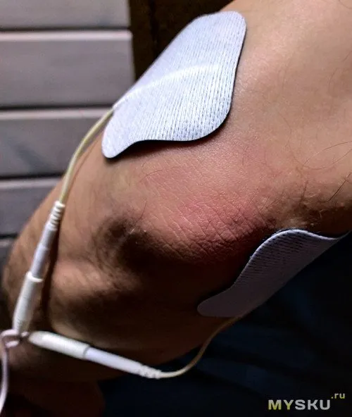 Аппарат Надежда 33 Аппарат Надежда 33