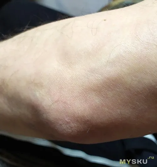 Аппарат Надежда 35 Аппарат Надежда 35