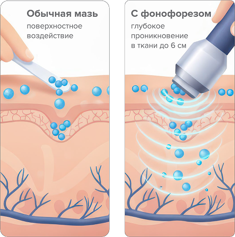 Как действует SELFDOCS АВРОРА — тройная сила воздействия