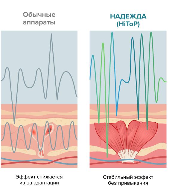 Как работает и в чём особенность