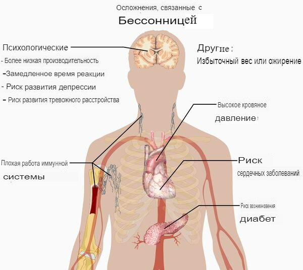 Осложнения_бессонница