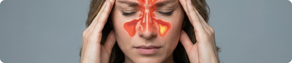 Синусит - воспаление околоносовых пазух