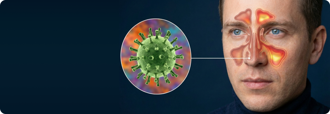 Причины синусита - вирусы и бактерии