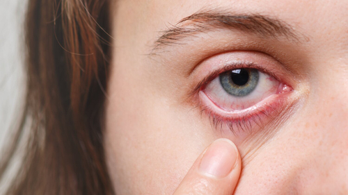 Что такое астенопия и как её лечить: диагностика и физиотерапия – Prodex