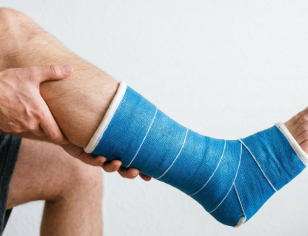 Перелом ноги Перелом ноги