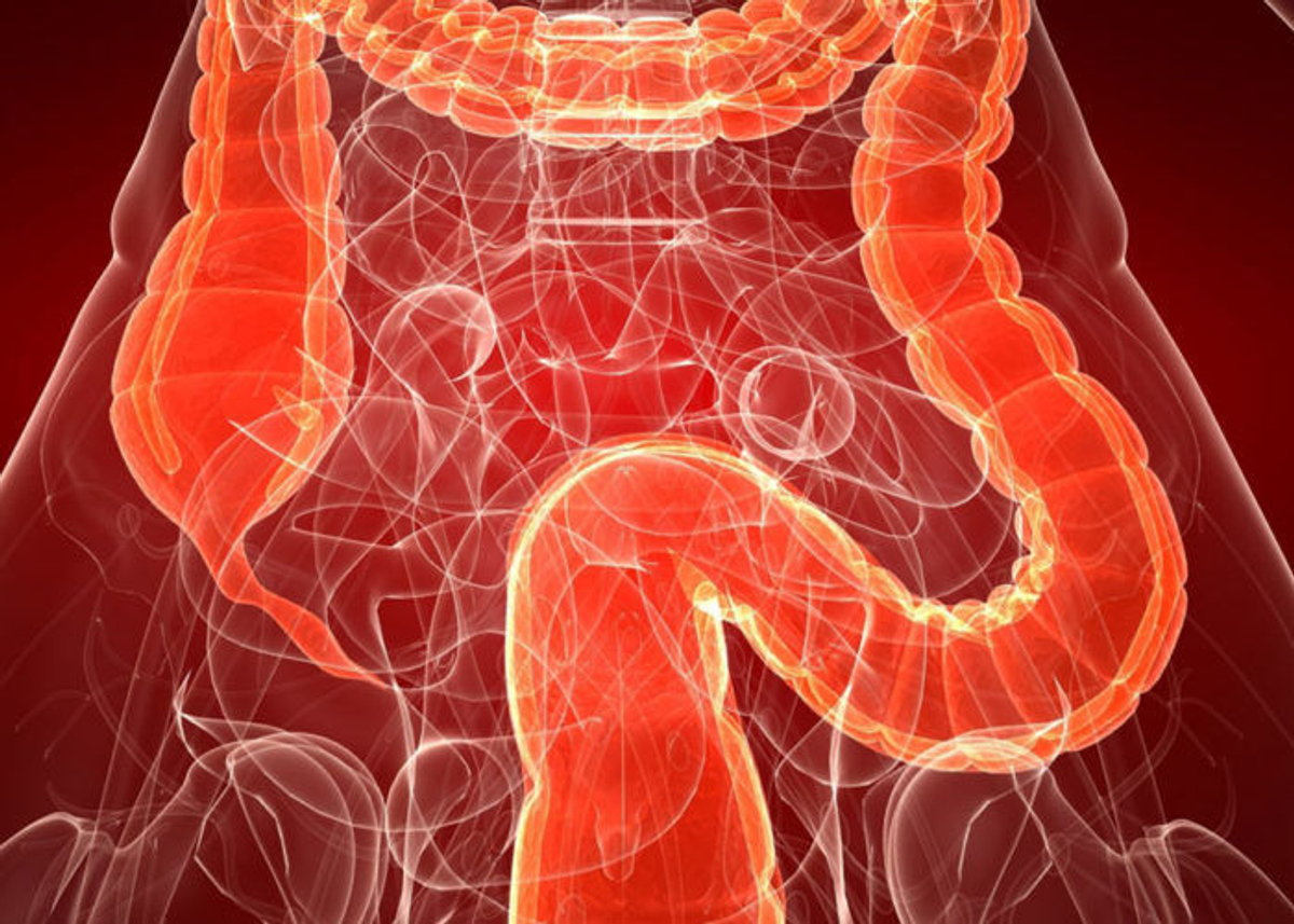 Атонический колит