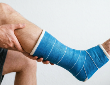 Перелом ноги