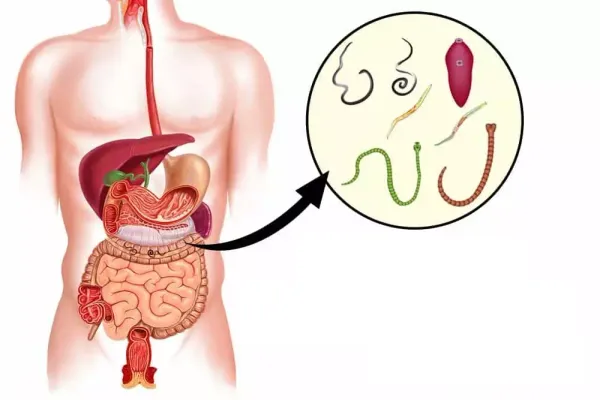 Паразиты в организме: как распознать и победить?